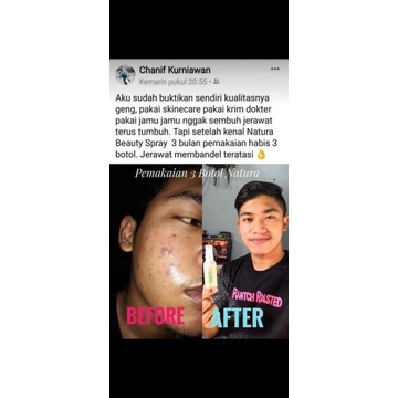 Xịt làm đẹp Natura | BigBuy360 - bigbuy360.vn