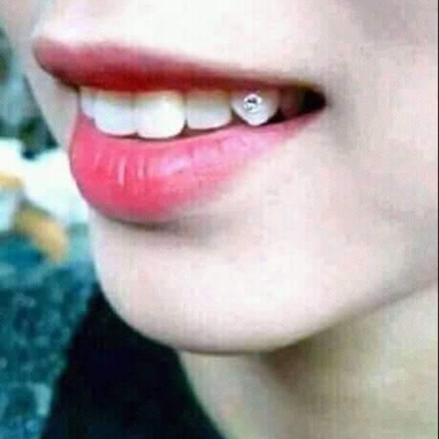 Đá đính răng 2k/viên