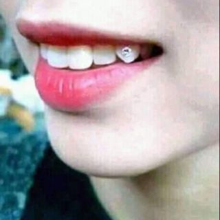 Đá đính răng 2k/viên