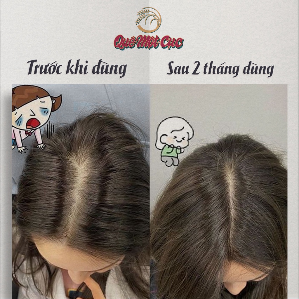 Tinh dầu bưởi mọc tóc (LOẠI CAO CẤP) siêu đậm đặc, chuyên kích mọc tóc con, làm dày, giảm rụng QUÊ MỘT CỤC 10ml