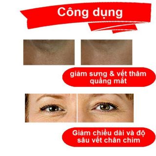 Kem trị bọng mắt Novosvit Nga