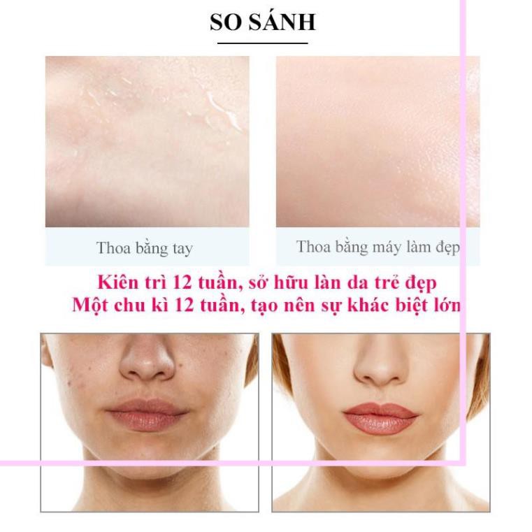 [Combo]Máy Massage Mặt Làm Đẹp Da Nâng Cơ Photon Nóng& Lạnh EMS+Máy Rửa Và Mát Xa Da Mặt Cho Da Nhạy Cảm-Beauty Top Spot | BigBuy360 - bigbuy360.vn