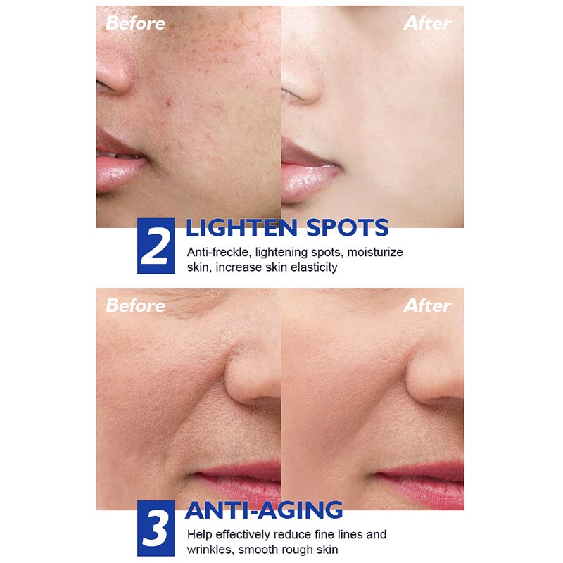 Kem Dưỡng Da Mặt Retinol 50g Dưỡng Ẩm Chống Lão Hóa Giảm Nếp Nhăn Làm Trắng Da