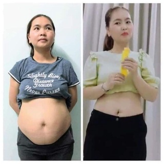 Thạch Dứa Giảm Mỡ Matxi Corp