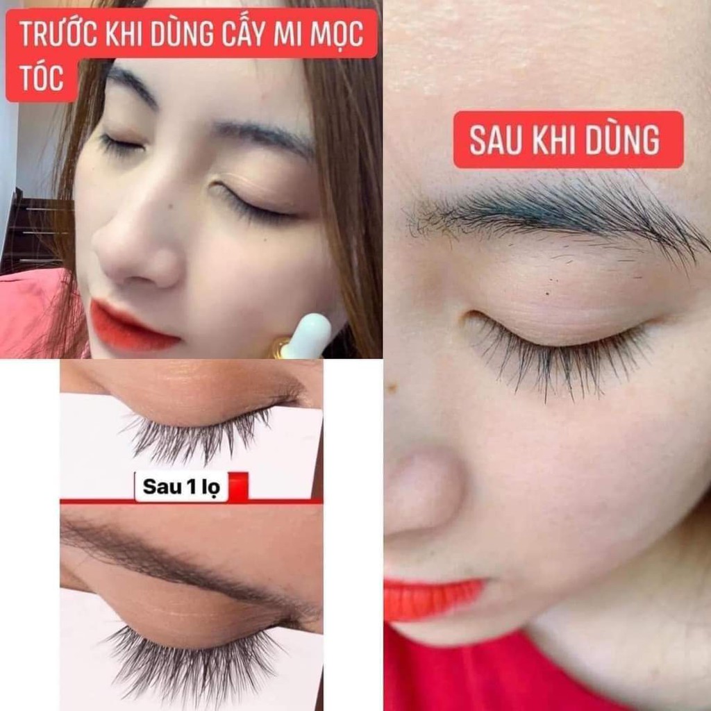 Dr HAIR  [ CHÍNH HÃNG] ❤️ Dr.HAIR TINH CHẤT CẤY TÓC CẤY LÔNG MÀY LÔNG MI - Dr Hair Zenpali