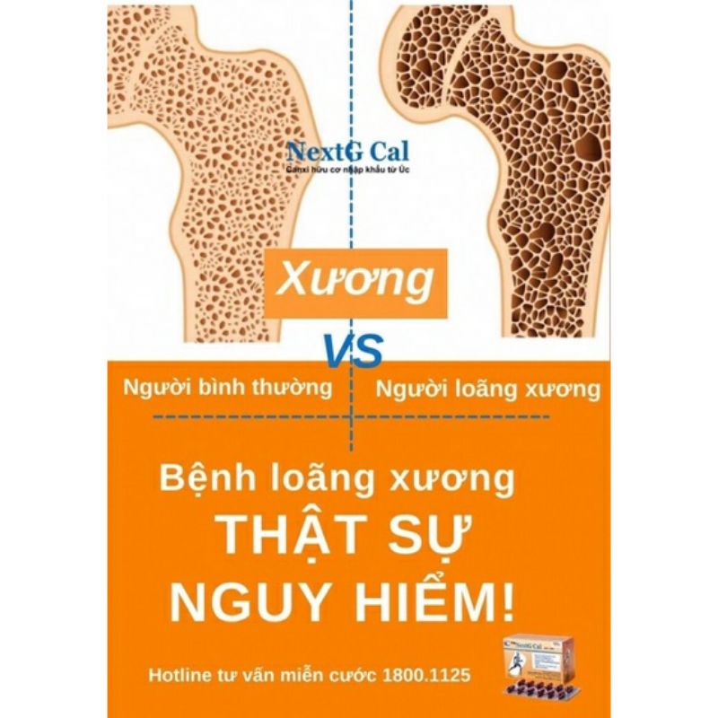 Viên Uống Bổ Sung Calci NextG Cal Hộp 60 Viên