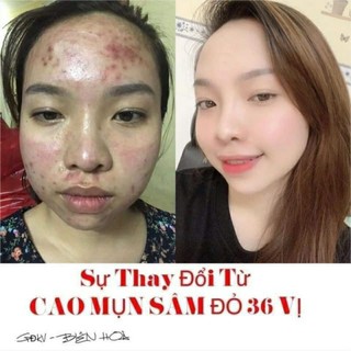 CAO MỤN SÂM ĐỎ 36 VỊ
