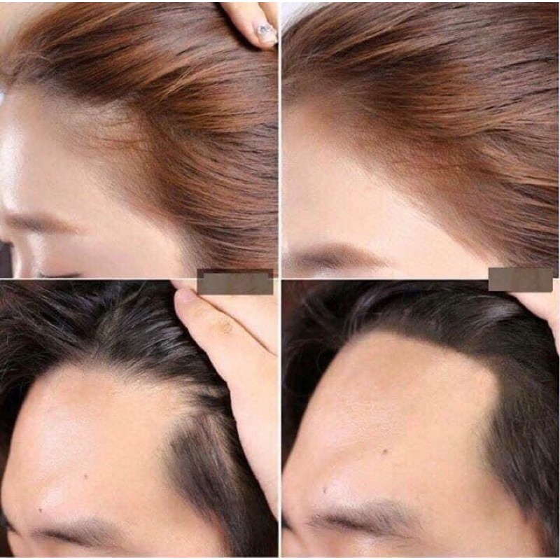 CHE KHUYẾT ĐIỂM CHÂN TÓC INNISFREE | BigBuy360 - bigbuy360.vn