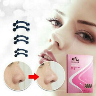 Sụn nâng mũi S-line Hàn Quốc
