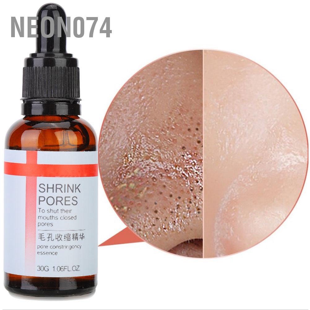 (ĐẸP+) Tinh chất dưỡng ẩm se khít lỗ chân lông loại bỏ mụn đầu đen cho da mụn, da dầu, kiểm soát nhờn