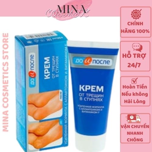 Kem dưỡng da tay chân [Hết nứt nẻ 100%-Hàng Auth] Kem chống nứt gót chân nga kpem foot cream 50ml