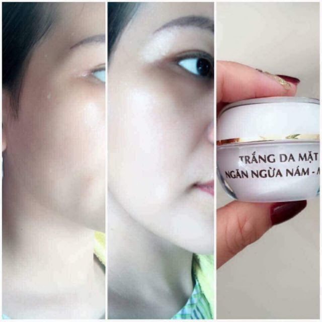 Combo kh đặt