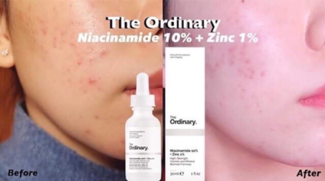 Serum The Ordinary AHA 30% + BHA 2% Peeling solution