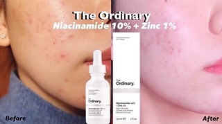 Serum The Ordinary AHA 30% + BHA 2% Peeling solution