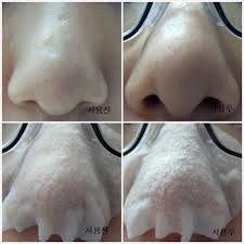 Mặt Nạ Đẩy Mụn Đầu Đen Ciracle Goodbye Blackhead Hiệu Quả, Không Gây Đau Rát