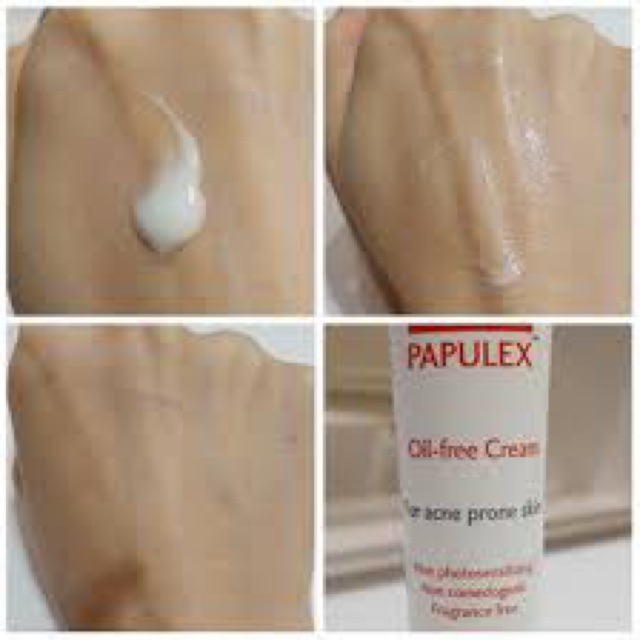 PAPULEX OIL FREE CREAM - Kem Giảm Bóng Nhờn - Ngăn Ngừa Sự Phát Triển Của Mụn - 40ml