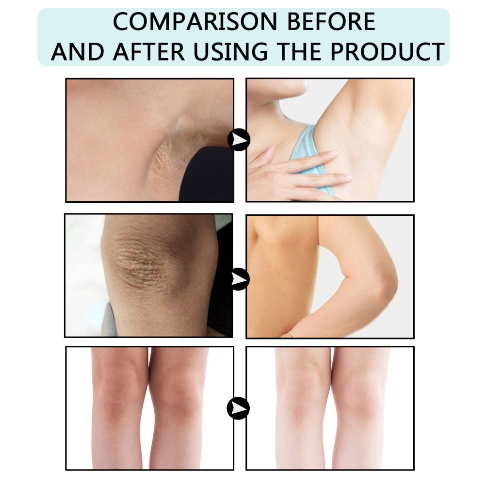 (Hàng Mới Về) Kem Dưỡng Trắng Vùng Da Dưới Cánh Tay / Đầu Gối / Khuỷu Tay Hiệu Eelhoe | BigBuy360 - bigbuy360.vn