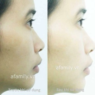 Kem giữ ẩm da vitamin E 