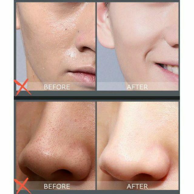 Tinh chất dưỡng da cho nam Skin Care Pro