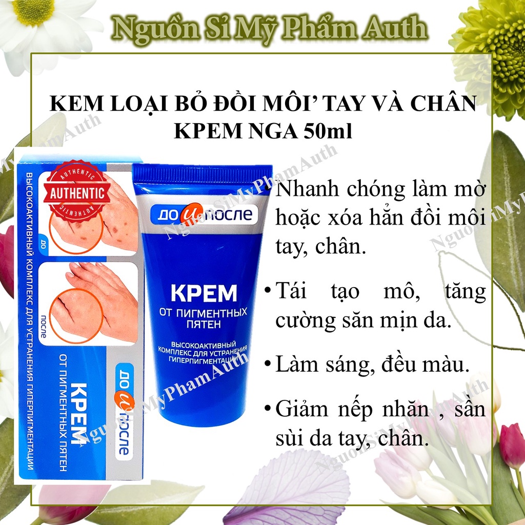 Kem đồi mồi Kpem Nga