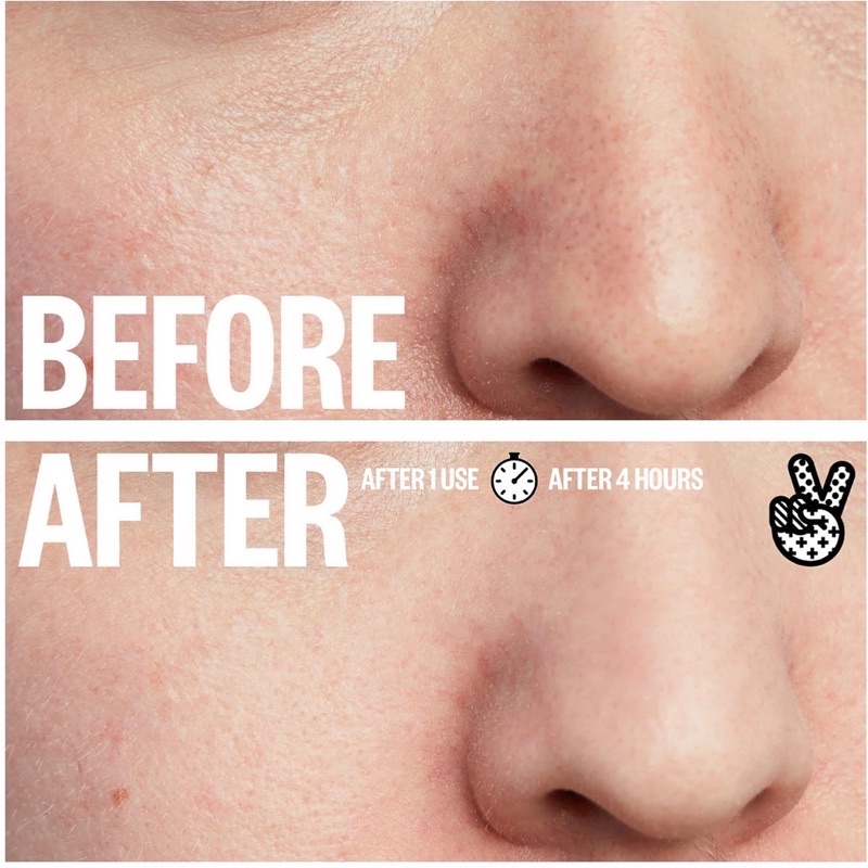 Miếng dán mũi Peace Out Oil-Absorbing Pore Treatment Strips