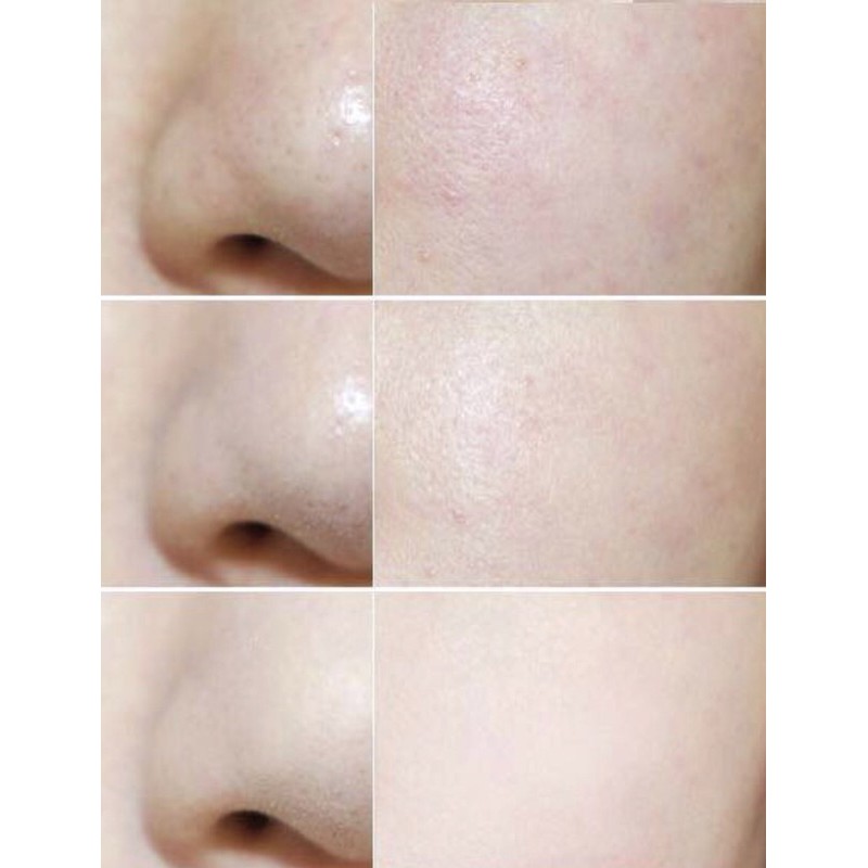 Phấn phủ kiềm dầu dạng nén Shiseido baby powder 50g ( Hàng nội địa Nhật) | BigBuy360 - bigbuy360.vn