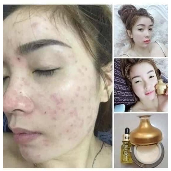 Kem dưỡng trắng da giảm thâm nám nhân sâm Ncollagen 25g - Tặng kèm sét tẩy té bào làm sạch da chết