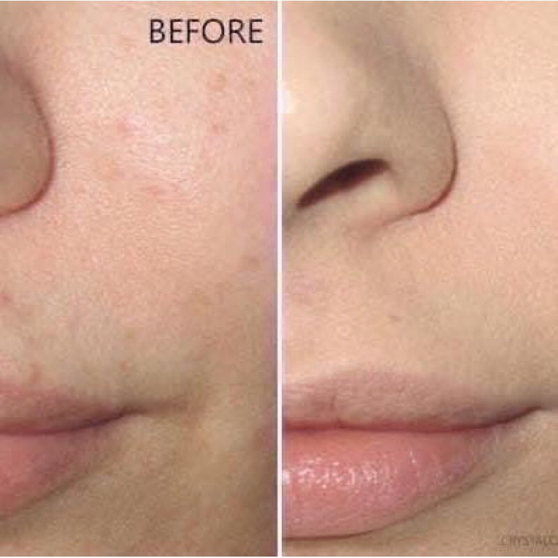 kem nền Nars natural radiant longwear foundation | BigBuy360 - bigbuy360.vn