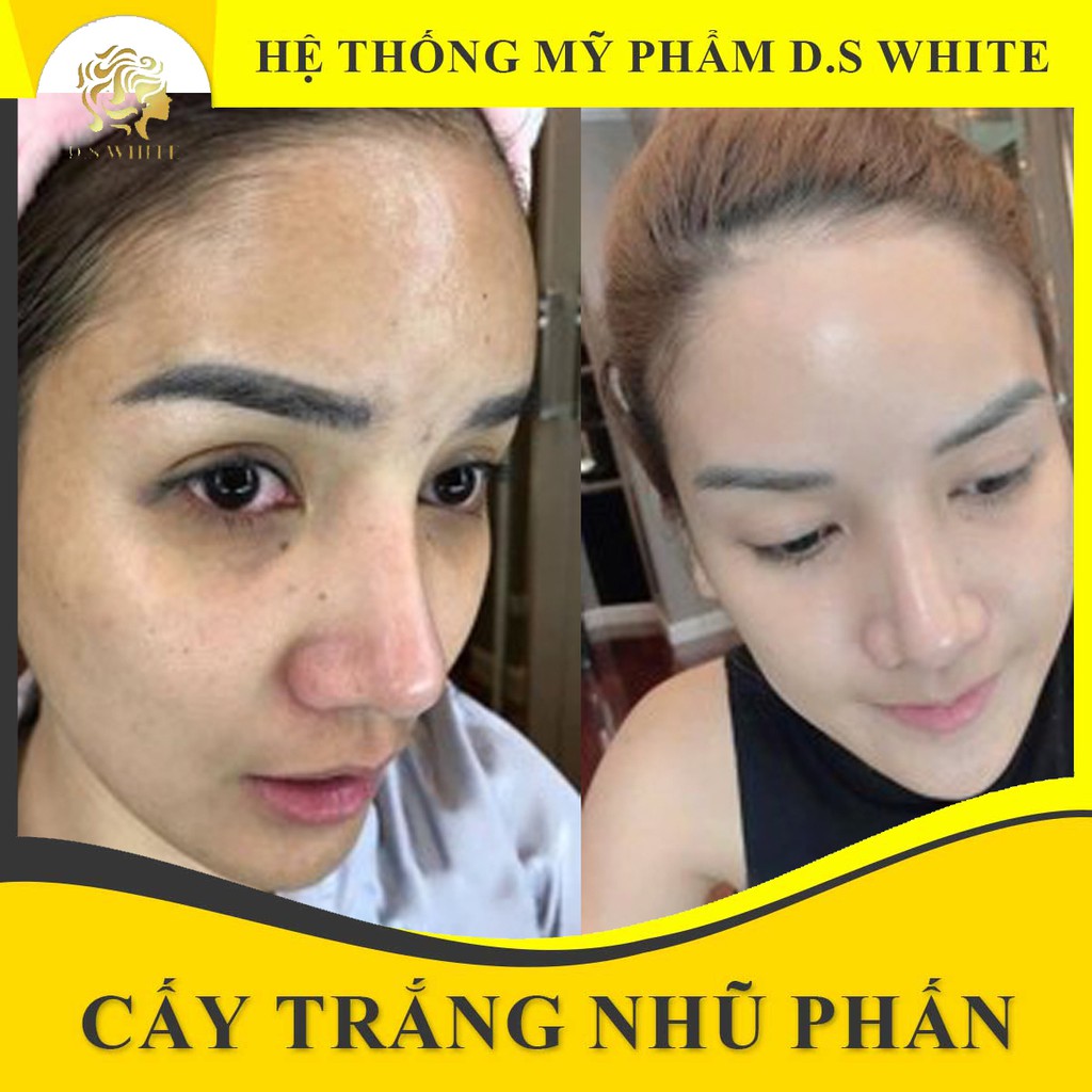 Bộ Cấy Trắng Da Mặt [Chính Hãng - DS White] - 3 Bước Làm Trắng Da Mặt Tại Nhà [Tặng máy cấy trắng ion]