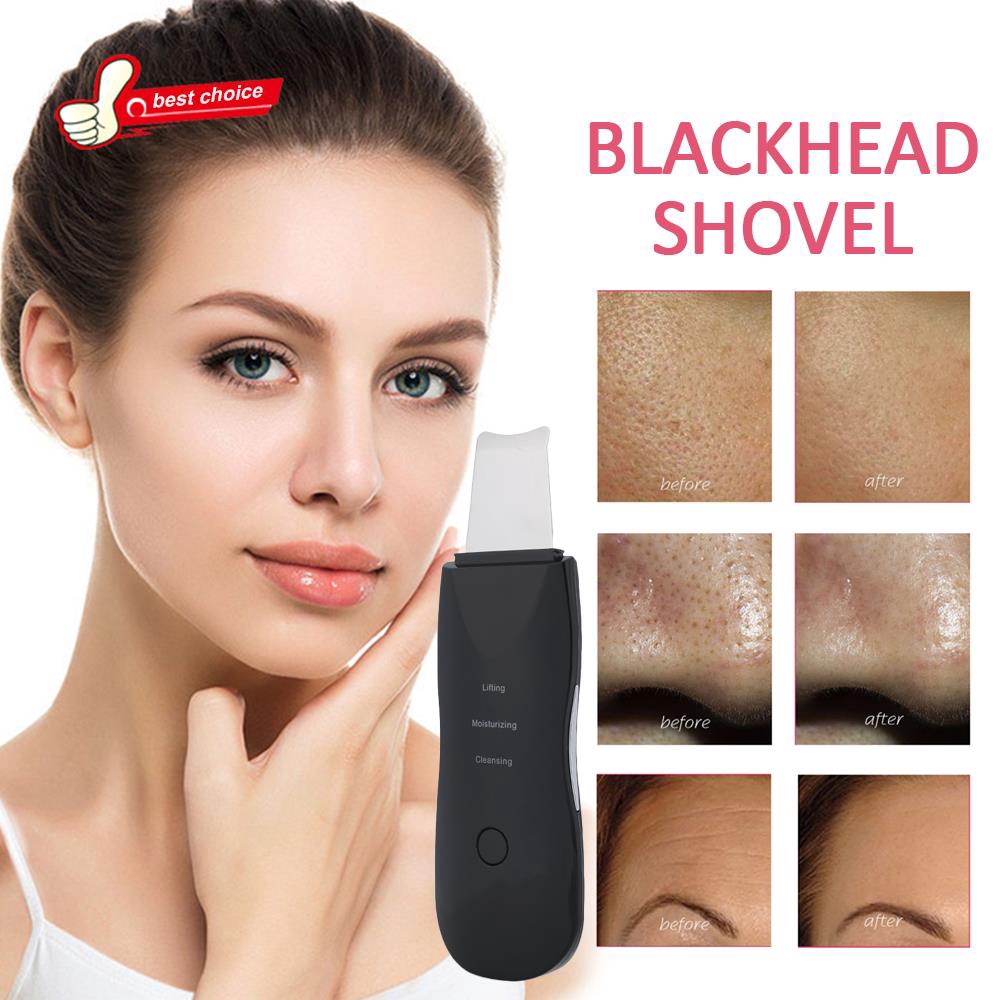 Máy cà da hút mụn làm đẹp hiệu quả màu đen | BigBuy360 - bigbuy360.vn