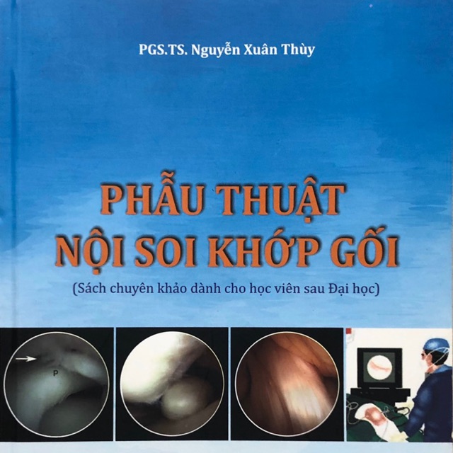 Sách - Phẫu thuật nội soi khớp gối