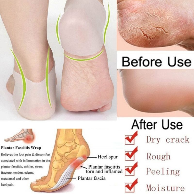 [Hàng mới về] Vớ silicon dưỡng ẩm chăm sóc gót chân