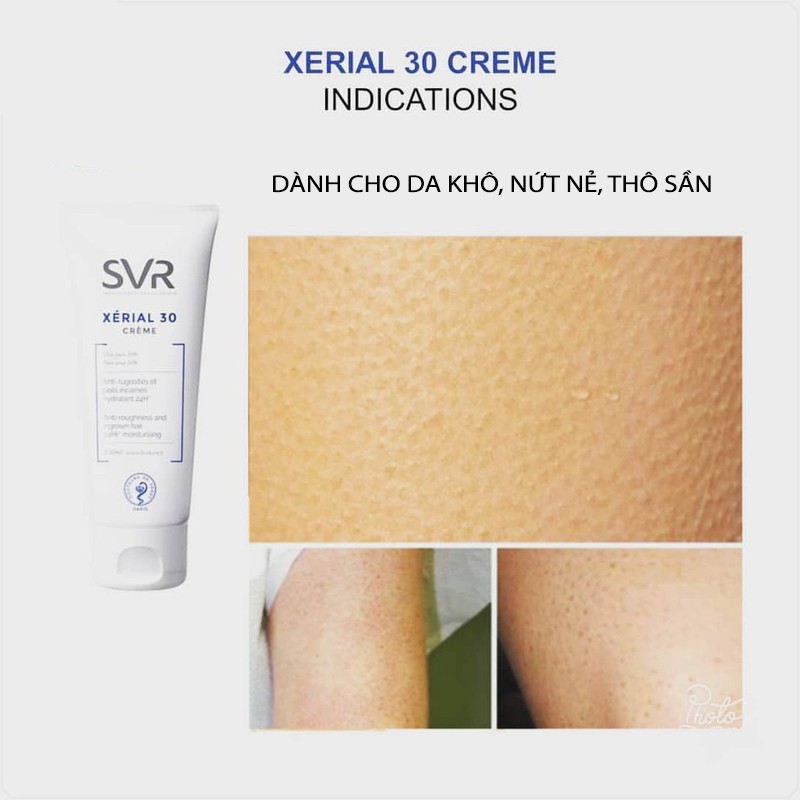 Kem dưỡng da, giữ ẩm dành cho da rất khô và da thô sần SVR XERIAL 30 Creme 100ml