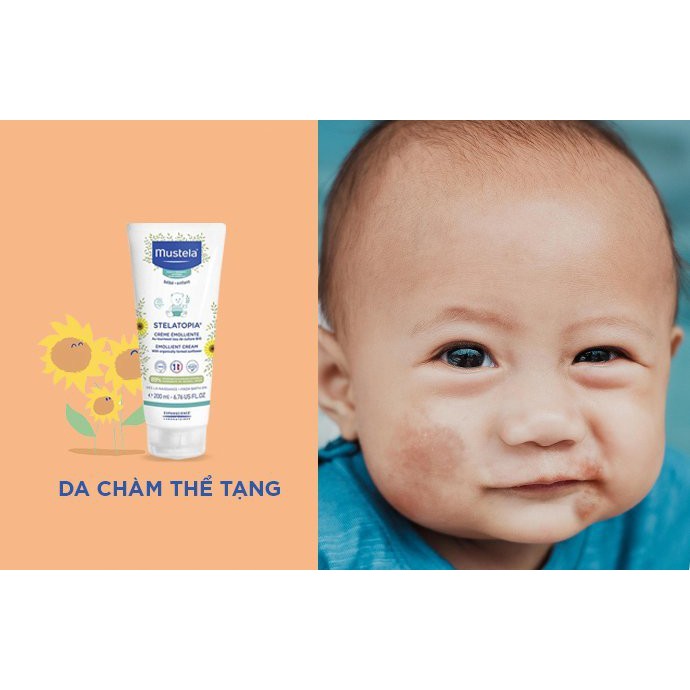 Mustela Kem Dưỡng Da Mặt Và Cơ Thể Cho Trẻ Sơ Sinh & Em Bé Da Chàm Thể Tạng Mustela 200ml