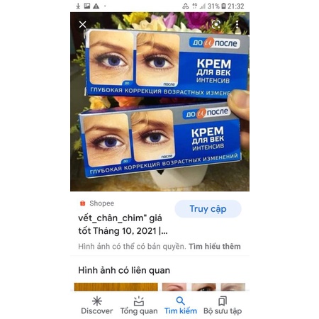 Kem giảm nhăn và chân chim mắt Kpem 30ml của Nga