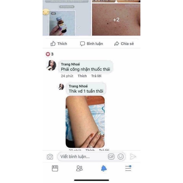 KELA LOTION TRỊ VIÊM LỖ CHÂN LÔNG 60ML | BigBuy360 - bigbuy360.vn