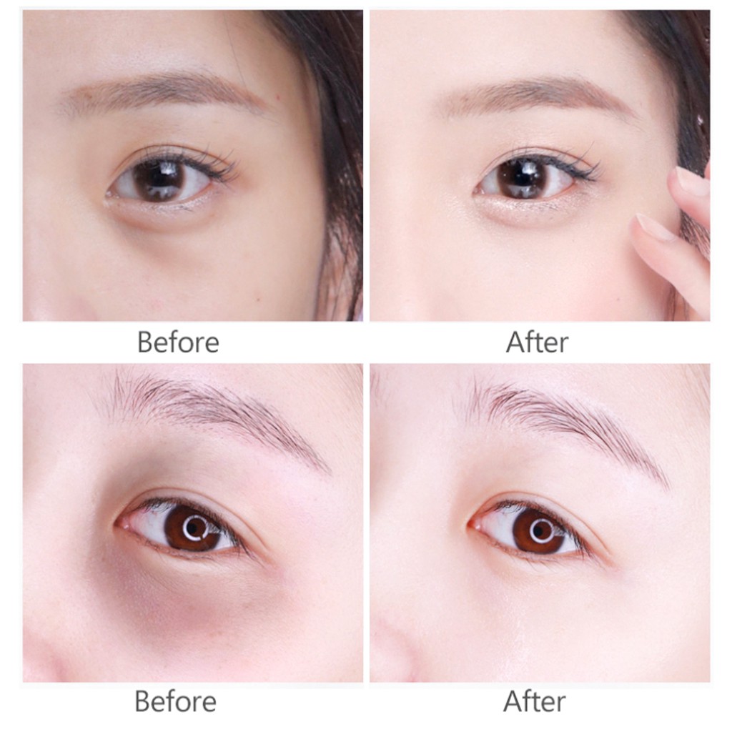 Gel Dưỡng Giảm Thâm Mắt Klairs Fundamental Eye Awakening Gel