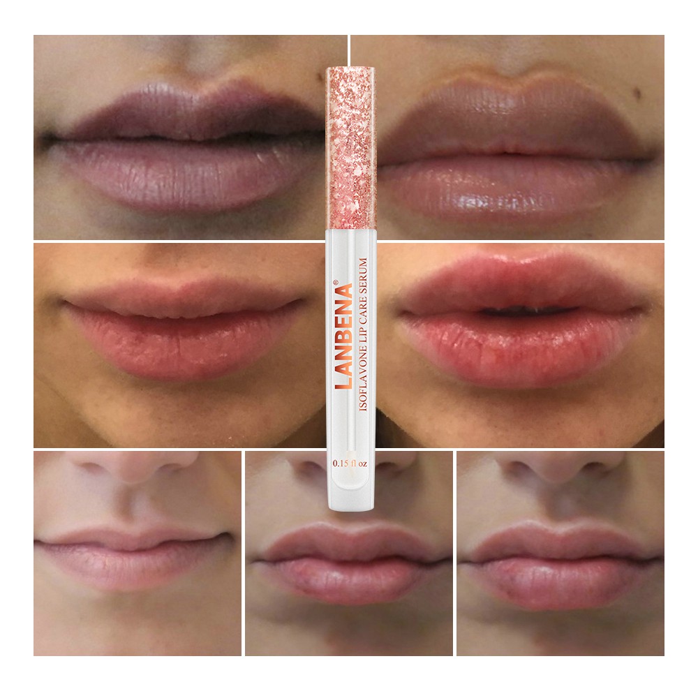 (Hàng Mới Về) Serum Dưỡng Môi Lanbena Giúp Môi Căng Mọng Và Giảm Đường Viền Môi | BigBuy360 - bigbuy360.vn