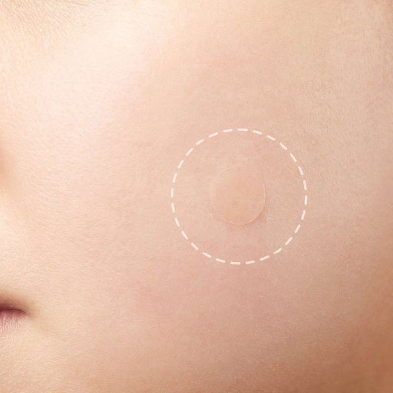 LAIKOU 36 posts Acne Patch Remover Pimple 5g | BigBuy360 - bigbuy360.vn