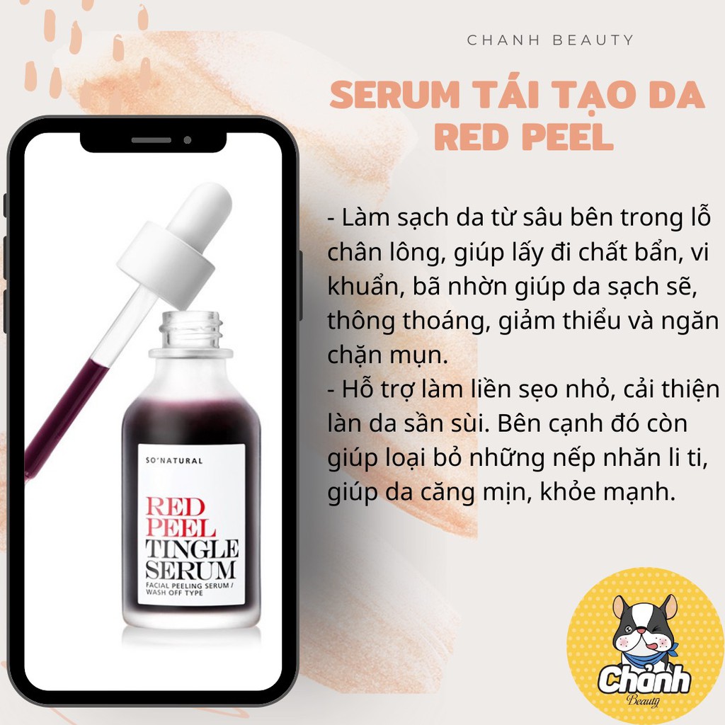 Tẩy Da Chết Hóa Học So' Natural Red Peel Tingle Serum