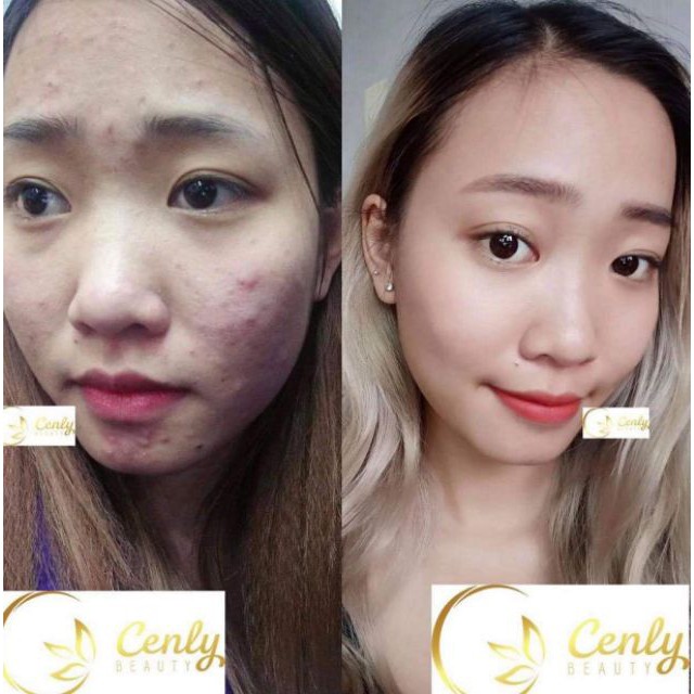 SERUM dưỡng ẩm TÁI TẠO DA, ngừa lão hóa  ( tặng kèm quà) | BigBuy360 - bigbuy360.vn