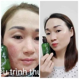 Serum mskin nhân sâm