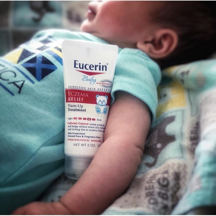 Kem dưỡng ẩm cho da bị chàm Eucerin