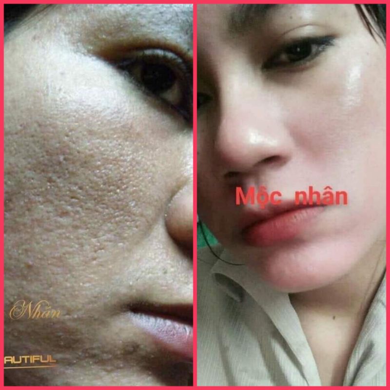 Đông Y Mộc Nhân Tái Tạo Da Thiên Nhiên Lọ 100ml