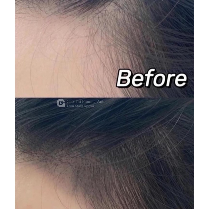 Tinh chất kích mọc tóc Sato Arovics Solution 5% 30ml Nhật Bản