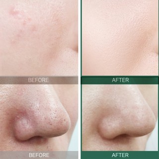 Serum Some By Mi AHA-BHA-PHA 30 Days Miracle
