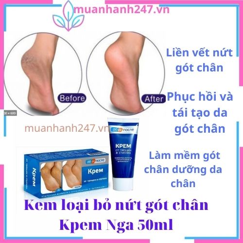 kem nẻ gót chân Kpem Foot Cream giảm nẻ chân nứt chân khô da chân dưỡng gót chân