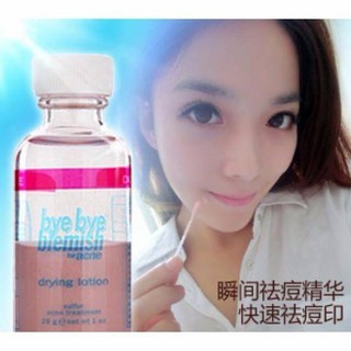 Kem Dành Cho mụn Bye Bye Blemish For Acne Drying Lotion