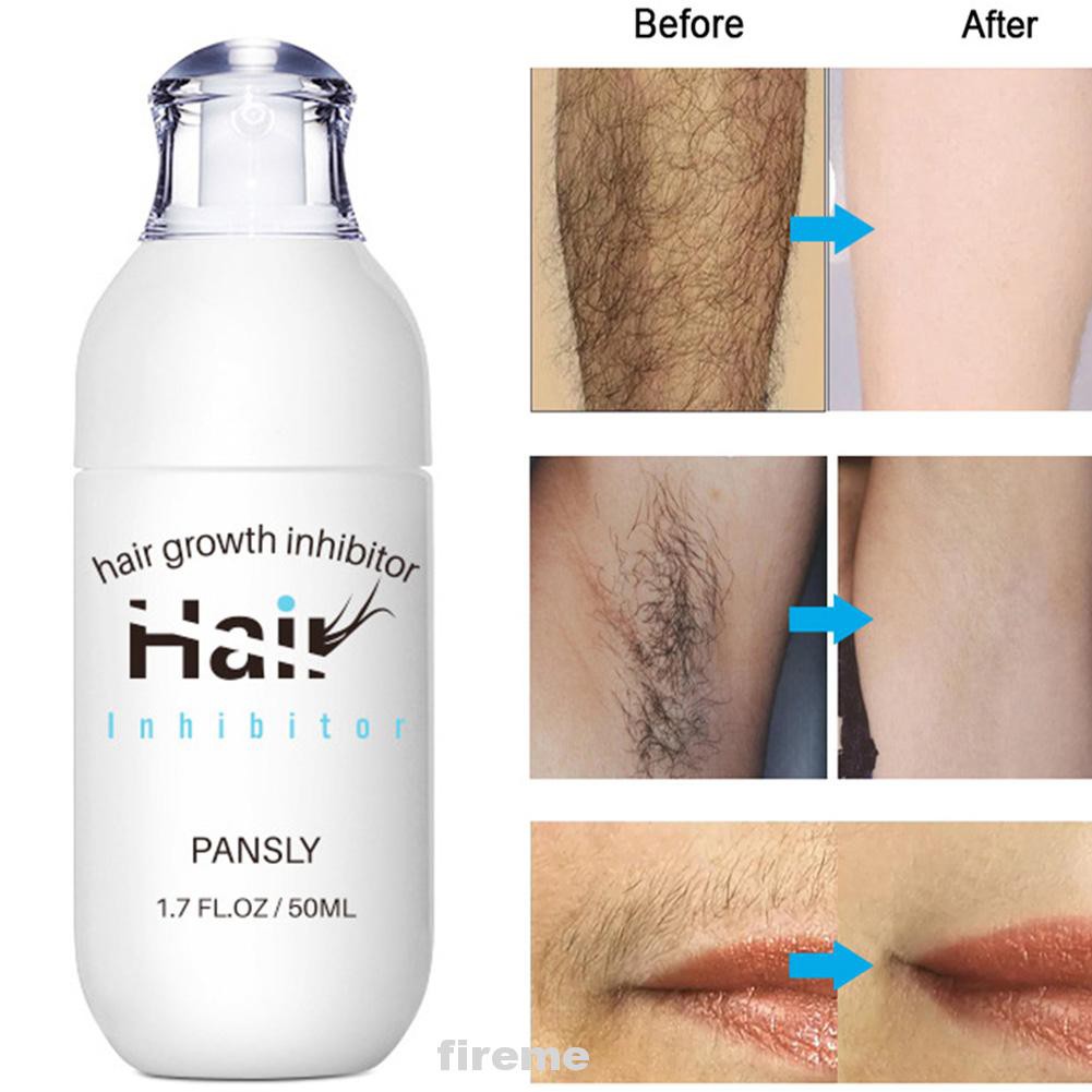 (Hàng Mới Về) Dung Dịch Tẩy Lông Vĩnh Viễn Thu Nhỏ Lỗ Chân Lông 50ml | BigBuy360 - bigbuy360.vn