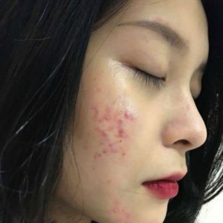 Combo serum tảo biển + face p1